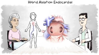 Epicardial ablation