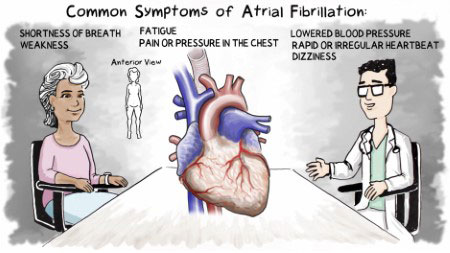 Common symptoms of Afib graphic